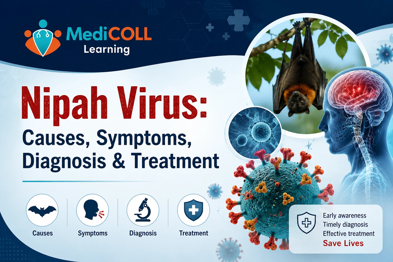 Nipah Virus: Causes, Symptoms, Diagnosis & Treatment